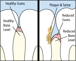 Periodontics